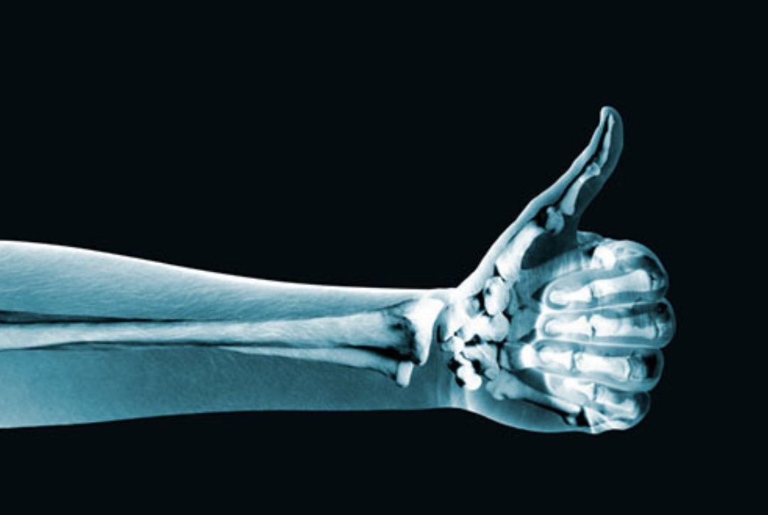 5 Reasons why you don t always need an Xray Ultrasound or MRI