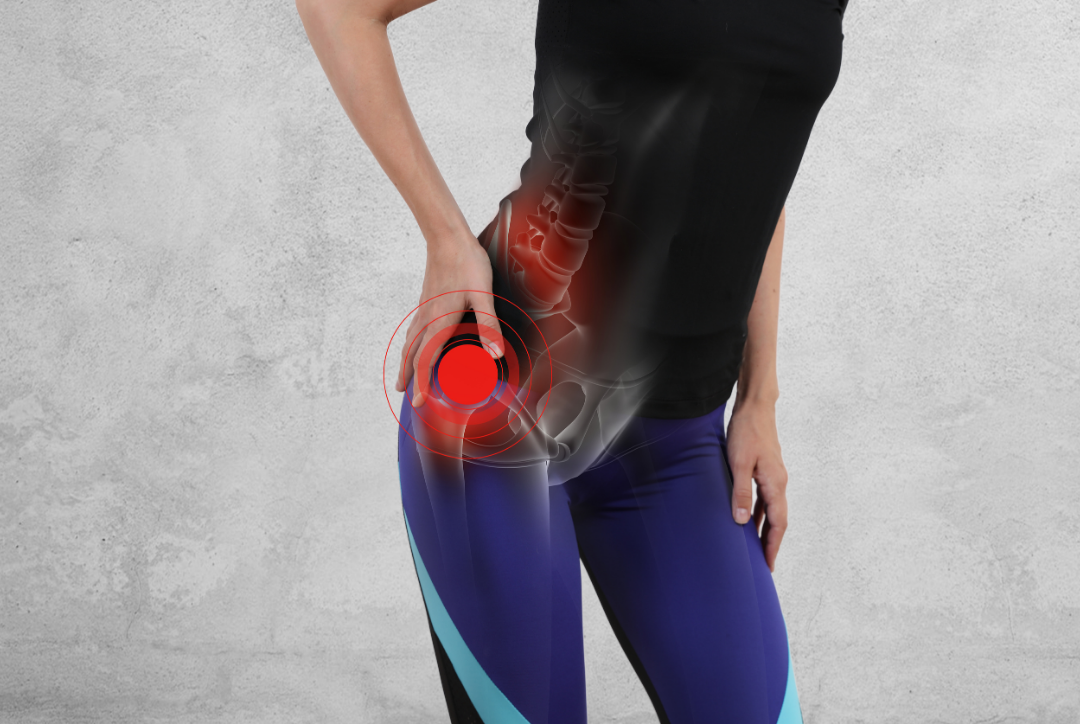 You probably don’t have hip “bursitis”